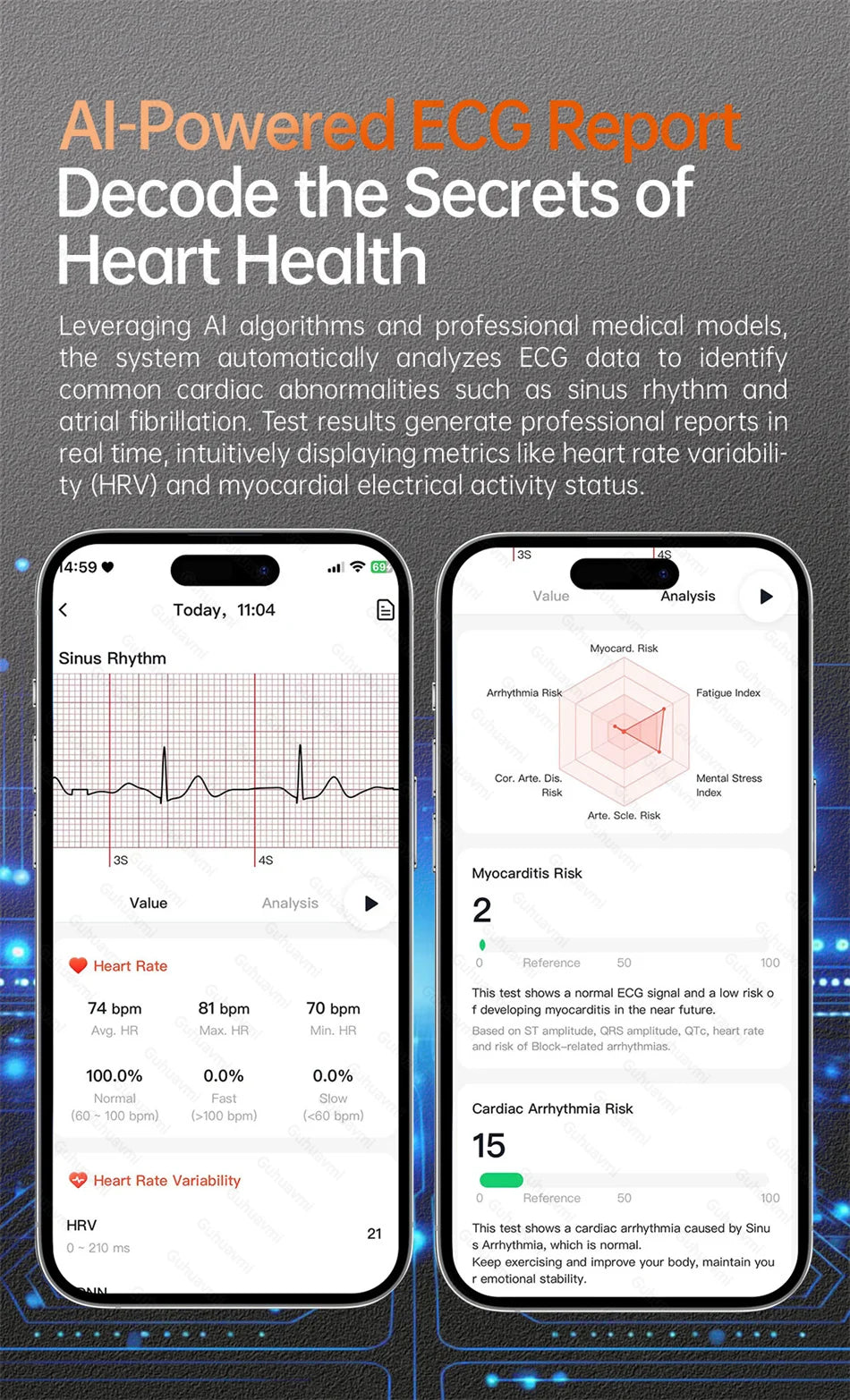 2025 nuevo reloj inteligente NFC ECG + PPG oxígeno en sangre ácido úrico presión arterial zafiro Smartwatch hombres para Samsung Galaxy Xiaomi Huawei